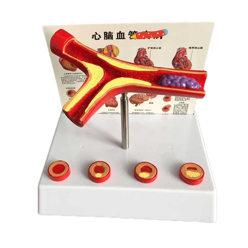 Medical Lab Supplies - อุปกรณ์ห้องปฏิบัติการแบบจําลองหลอดเลือดหลอดเลือดมนุษย์ขยาย 50 เท่า