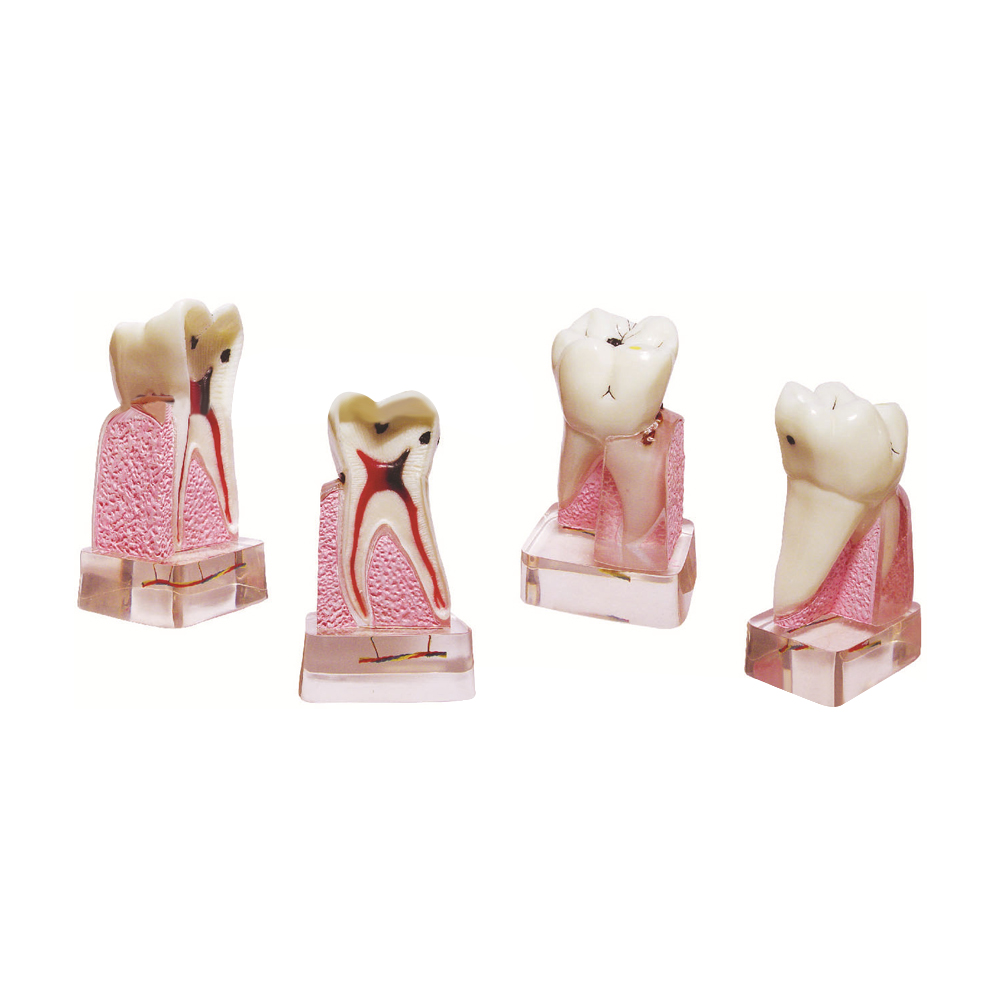 แบบจำลองทางพยาธิวิทยาทางทันตกร - Medical Lab Supplies บทวิจารณ์และราคา